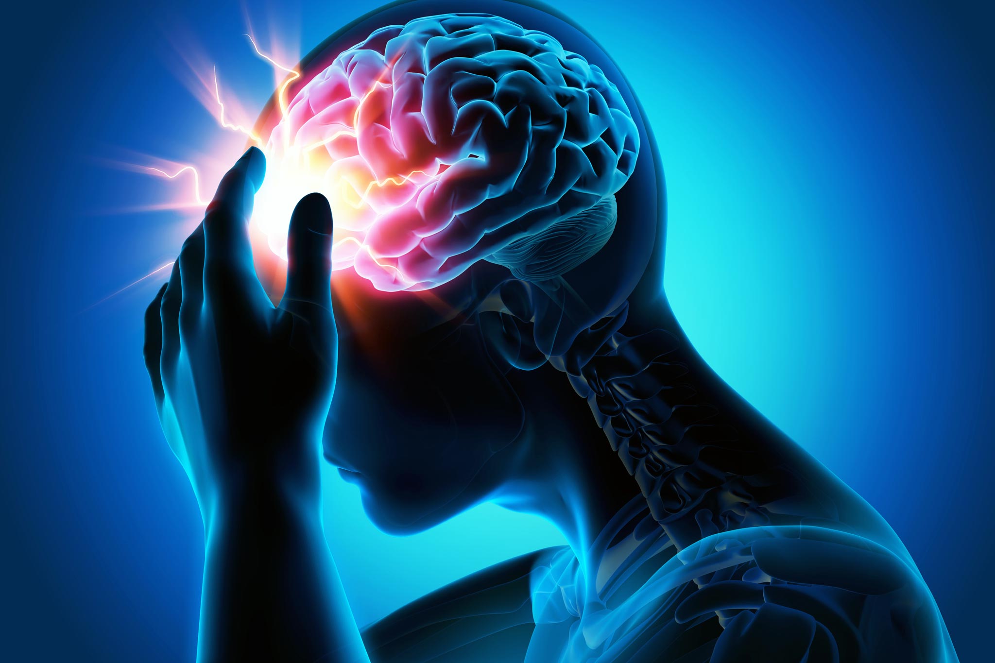 Migraine Management: TMS for Migraines and Other Treatment Options